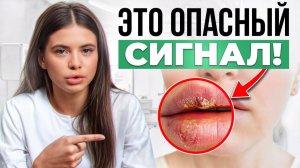 Такое проявление ГЕРПЕСА ОПАСНО для здоровья! Неочевидные причины ГЕРПЕСА!