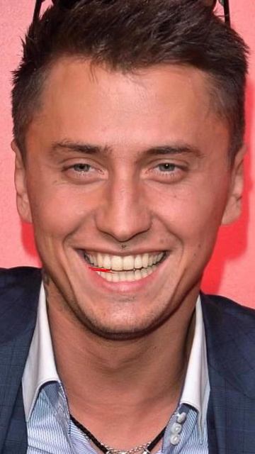 Разбор улыбки 🦷