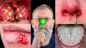 ➡️ 4 УПРАЖНЕНИЯ, ЧТОБЫ НЕ ЗАБОЛЕТЬ В КОНЦЕ ЗИМЫ-НАЧАЛЕ ВЕСНЫ