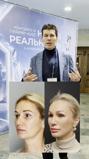 Невидимый лифтинг или невидимая подтяжка лица! #сергейсвиридов смотреть онлайн