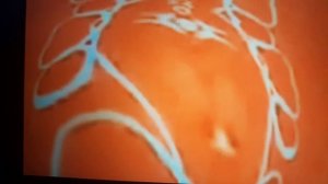 Aeopich! 2024 POMLOA Eoytpace