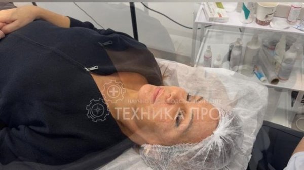 Фотодинамическая терапия