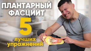 Комплекс упражнений при плантарном фасциите