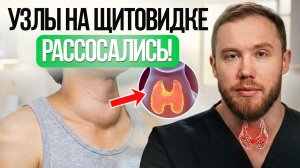 Как уменьшить УЗЛЫ ЩИТОВИДНОЙ железы САМОСТОЯТЕЛЬНО? Лечение щитовидки БЕЗ ОПЕРАЦИЙ!