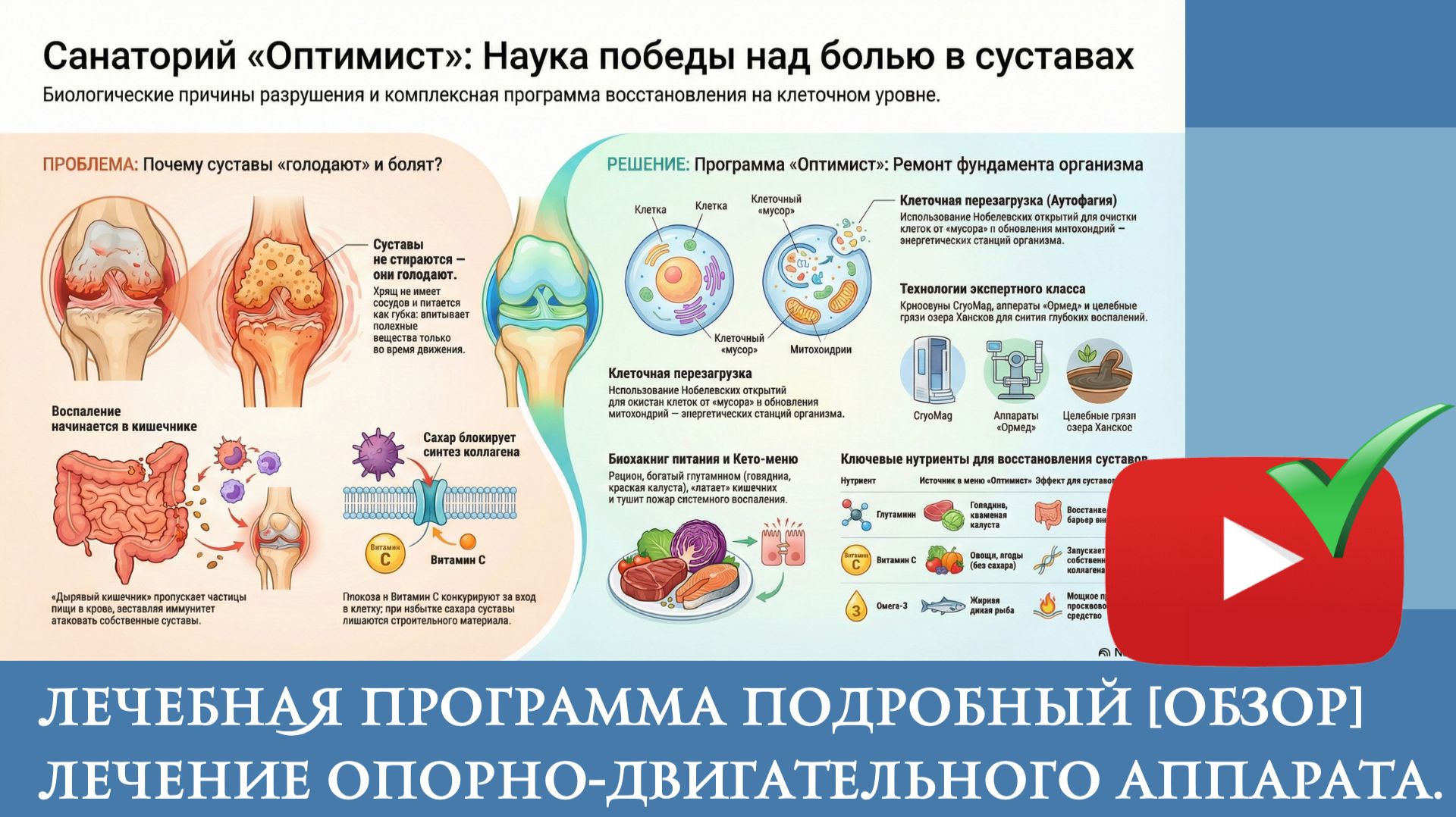 Lecheniye_Oporn_o-dvigatel'nyy_appa_rat_v_sanatorii_Optimist смотреть онлайн