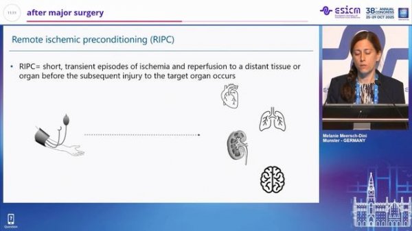 Kidney injury management after major surgery Melanie Meersch