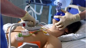 СЛР бригада 3 человека