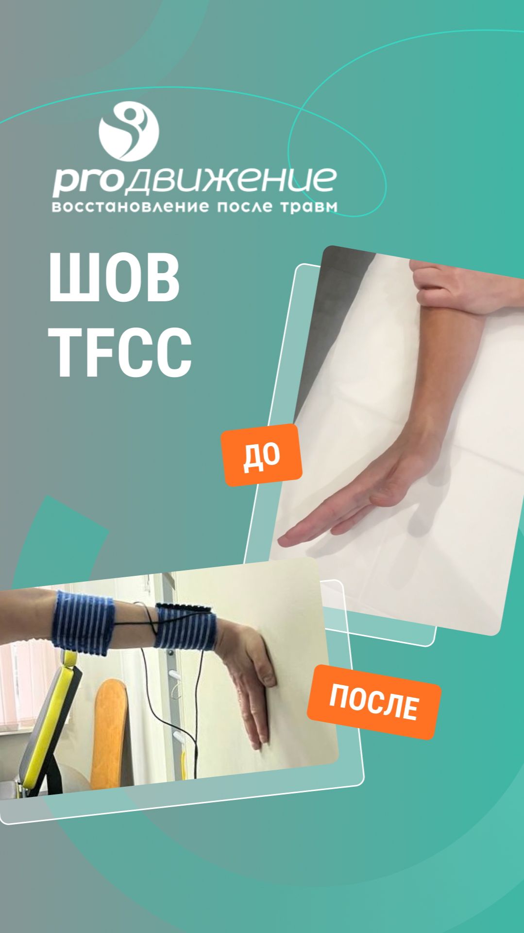 📌 Реабилитация по восстановлению полного пассивного и активного объема движений кисти и пальцев
