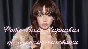 Фото Вали Карнавал до и после пластики: что изменила в себе блогерша к 24 годам