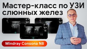 УЗИ слюнных желез в практике врача УЗД: мастер-класс на Mindray Consona N8