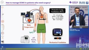 How to manage ECMO in patients who need surgery Fabio Silvio Taccone
