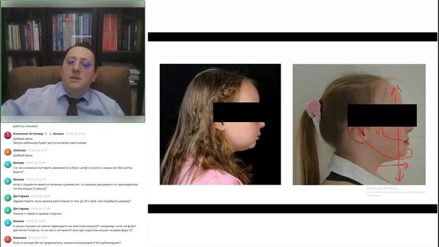 Sagittal First в действии: практика применения аппарата Motion 3D для лечения сагиттальных аномалий смотреть онлайн