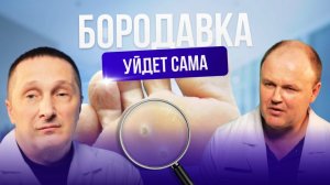 Как избавиться от подошвенной бородавки за 1 день