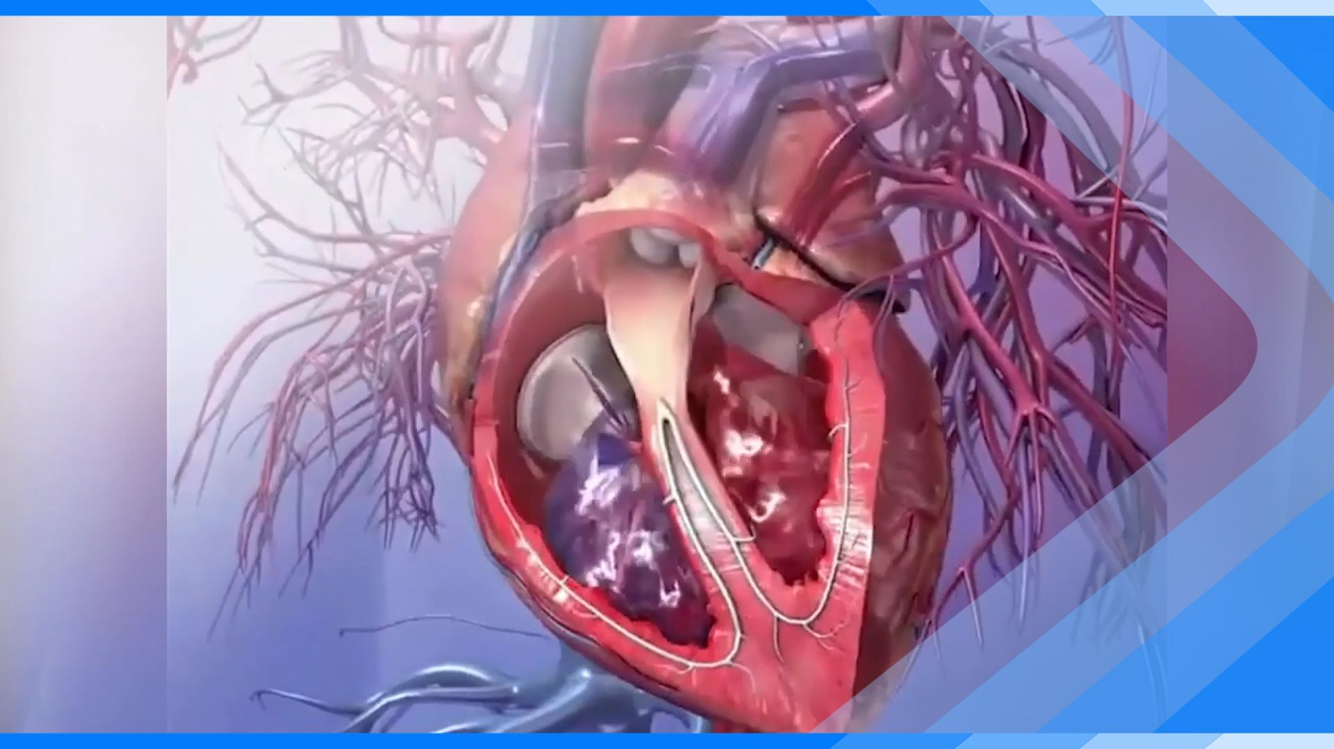 11.02.2026 День осведомленности о пороках сердца – врожденных и приобретенных смотреть онлайн