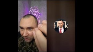 Украинство это болезнь. Наглядный пример.