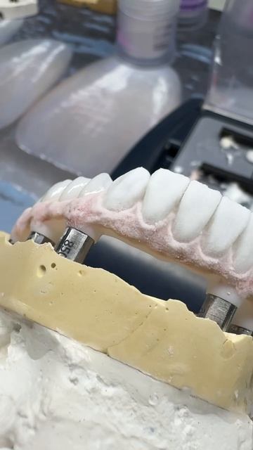 Жевательные зубы всегда полная анатомия. Показать результат после спекания?🤔