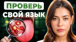 Ваш язык КРИЧИТ о болезнях! / Как определить болезнь по цвету языка?