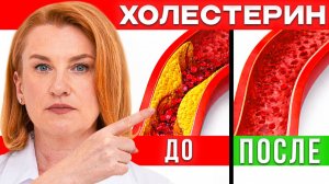 Как СНИЗИТЬ ХОЛЕСТЕРИН? Уберите ХОЛЕСТЕРИН и БЛЯШКИ в сосудах НАВСЕГДА