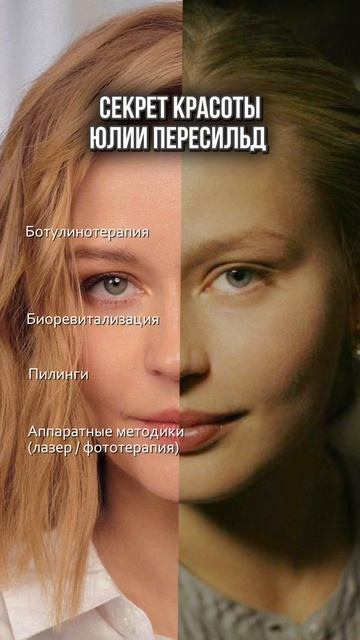 Что у косметолога сделала Юлия Пересильд? смотреть онлайн