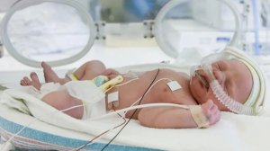 Последствия преждевременных родов