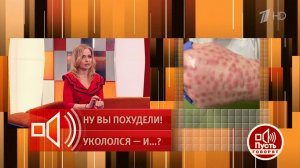 "Лечение последствий заняло два года!" Косметолог рассказала, как купила подделку на маркетплейсе...