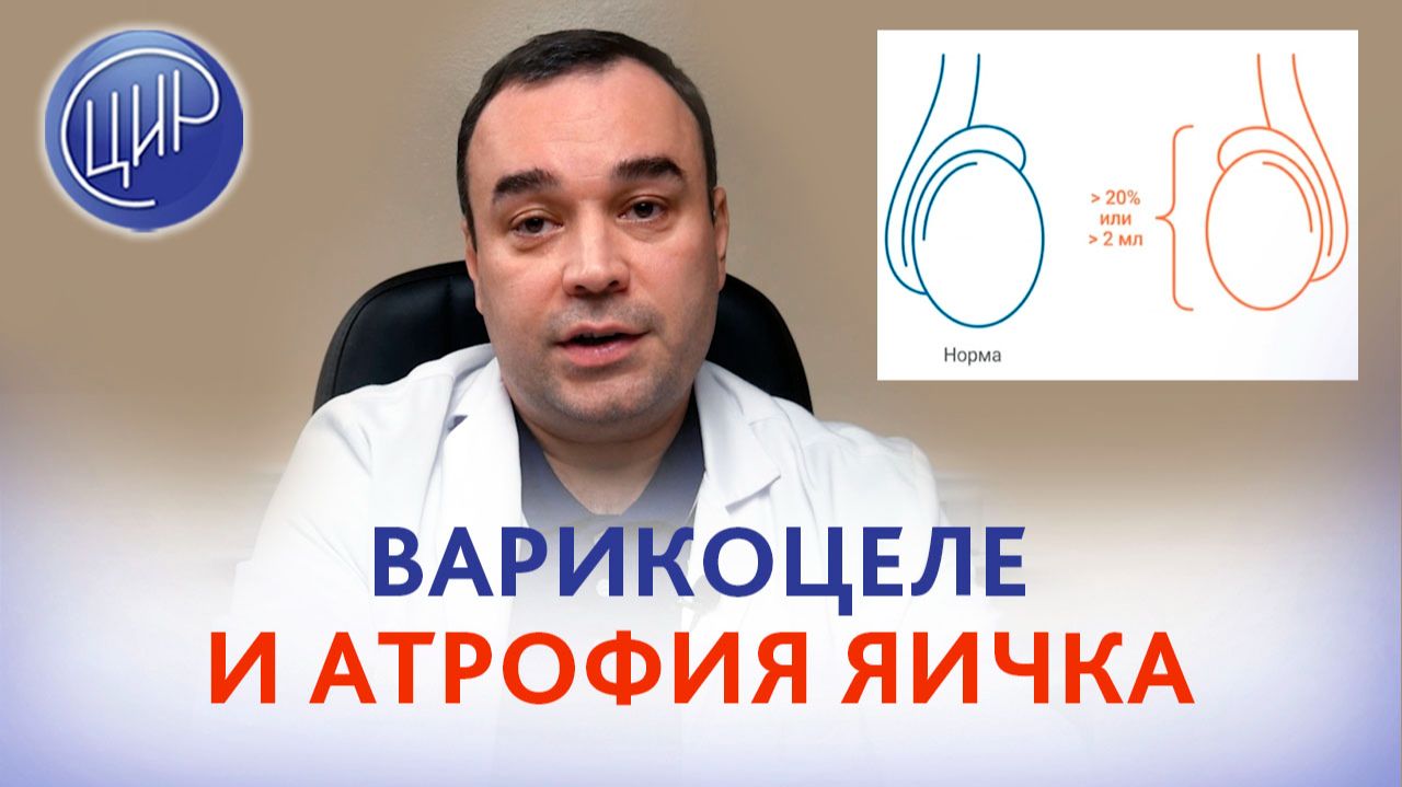 Варикоцеле и риск атрофии яичка. Уролог-андролог ЦИР, Эмиль Равильевич Абдулхакимов.