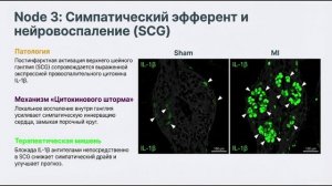 Как мозг добивает сердце после инфаркта