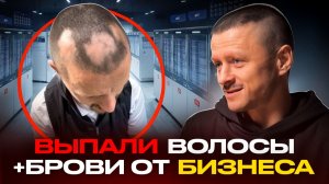 «У МЕНЯ ВЫПАЛИ ВОЛОСЫ И БРОВИ ОТ БИЗНЕСА — Как это исправил без гормонов?! »