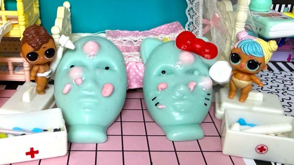 У СКВИШ - ПРЫЩ!😲😲 Давай скорей лечиться! Куклы ЛОЛ сюрприз СЕМЕЙКИ ПОМЕНЯЛИСЬ ДЕТЬМИ мультики