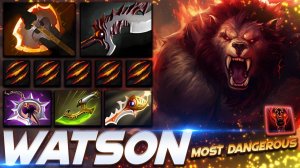 Watson Ursa — профессиональный геймплей в Dota 2 [Смотри и учись]