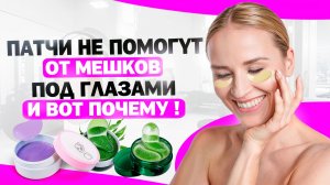 📌 ОТЕКИ И МЕШКИ ПОД ГЛАЗАМИ: причины и возможные решения