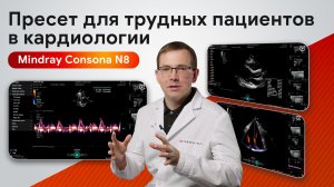 Mindray Consona N8 в кардиологии: пресет Cardiac Difficult в клинической практике
