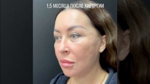 Комплексная операция по омоложению