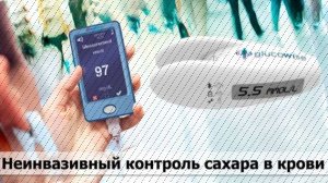 🌡 ГЛЮКОМЕТР КУПИТЬ В УКРАИНЕ ЦЕНА 🔵 КУПИТЬ АППАРАТ ДЛЯ ИЗМЕРЕНИЯ ХОЛЕСТЕРИНА 👌