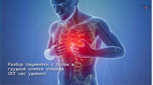 Разбор пациентки с болью в грудной клетке спереди. СКТ нас сильно удивило