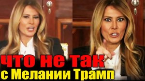 Скандал года: Всплыла вся правда о Мелании Трамп! Она Жертва или хищница?