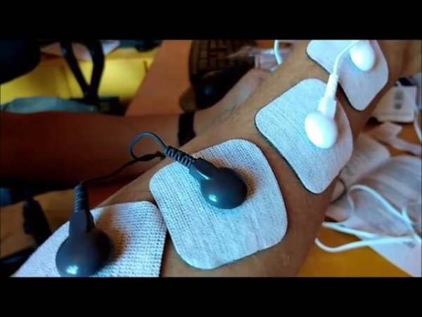 Миостимулятор sanitas sem 43. Массажёр и электрофорез на дому.