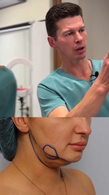 Не нужна в молодомвозрасте никакая подтяжка ! смотреть онлайн