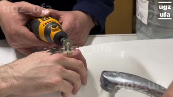 Уфимец проснулся с неприятным сюрпризом на пальце