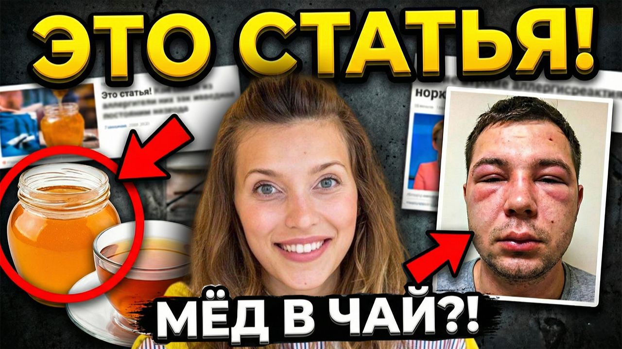 Регина Тодоренко чуть не убила друга ради эксперимента. Скандал с аллергией смотреть онлайн
