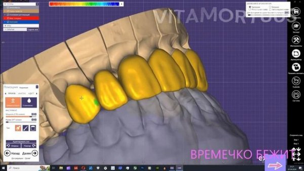 EXOCAD 10 MIN CHAllENGE MODELING ЭКЗОКАД 10 МИНУТ ЧЕЛЕНЖ МОДЕЛИРОВКА зубные техники стоматология СПБ