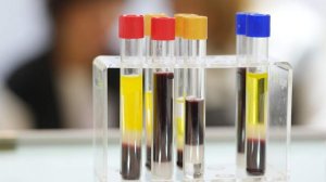 Число пациентов с оспой обезьян в Домодедовской больнице выросло до трех