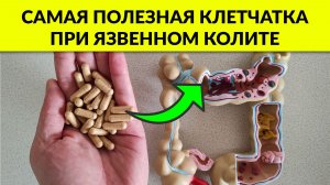Мировая Практика: Какая КЛЕТЧАТКА Помогает при ЯЗВЕННОМ КОЛИТЕ