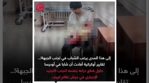 صورة ريل - شاب في أوديسا حاول قطع ذراعه بنفسه لتجنب التجنيد الإجباري في جيش نظام كييف