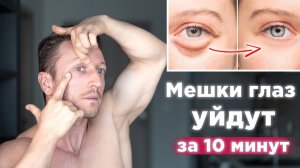 Как быстро убрать МЕШКИ И ОТЕКИ ПОД ГЛАЗАМИ Упражнения от мешков под глазами