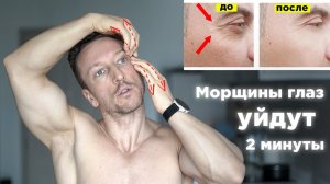 Как быстро убрать МОРЩИНЫ У ГЛАЗ Упражнения от морщин вокруг глаз