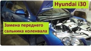 Замена переднего сальника коленвала Hyundai i30