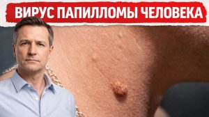 Папилломы на коже: что это и как убрать их в домашних условиях