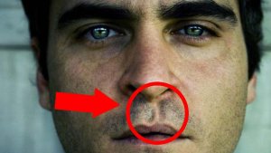 Еще один Топ 6 самых страшных дефектов знаменитостей