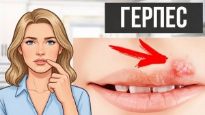 Герпес на губах: главные признаки и эффективное лечение в домашних условиях